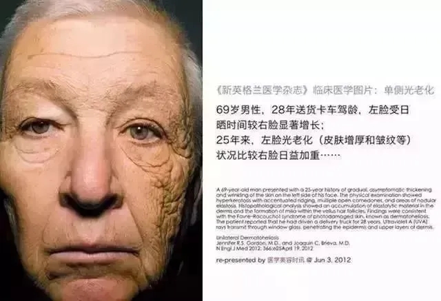 ���������Ƥ��������������û�л�����Ʒ����������ôԵ��ԭ��ֻ��һ������