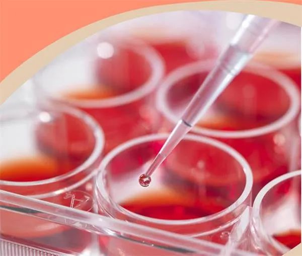 ¿ªÃÀÈÝÔºÏîÄ¿¼ÓÃËÒªÏÈŪ¶®Ê²Ã´ÄØ?